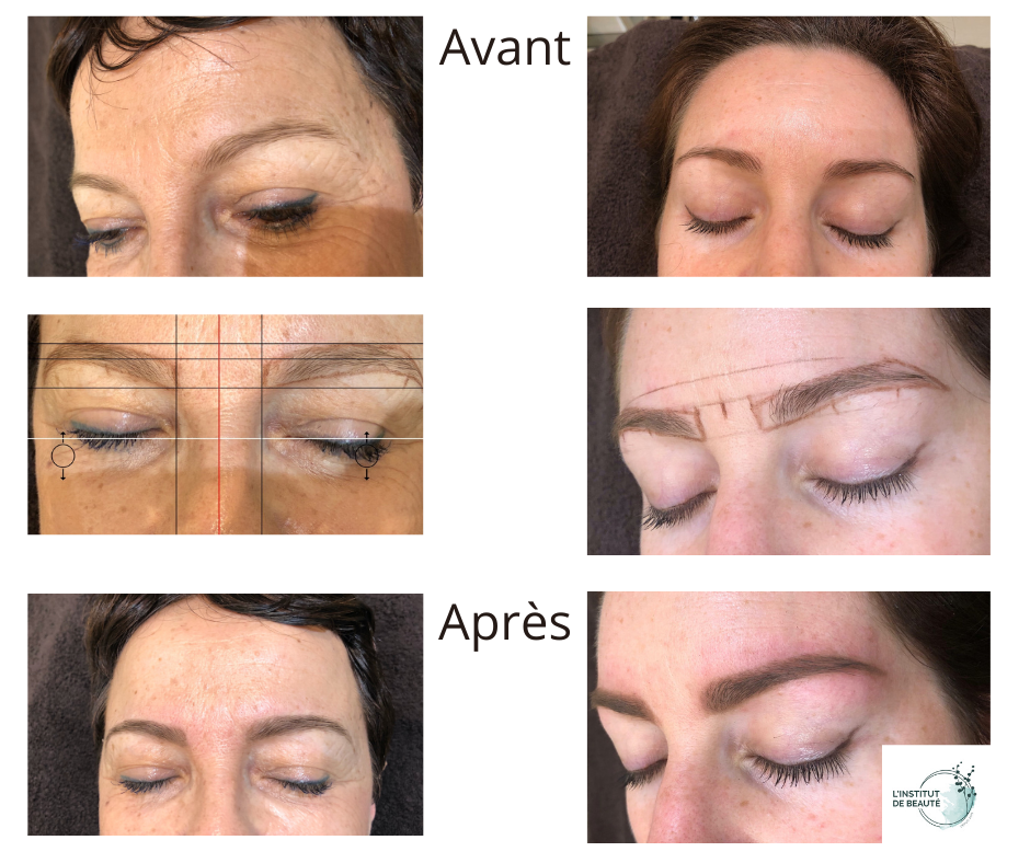 La Restructuration des sourcils